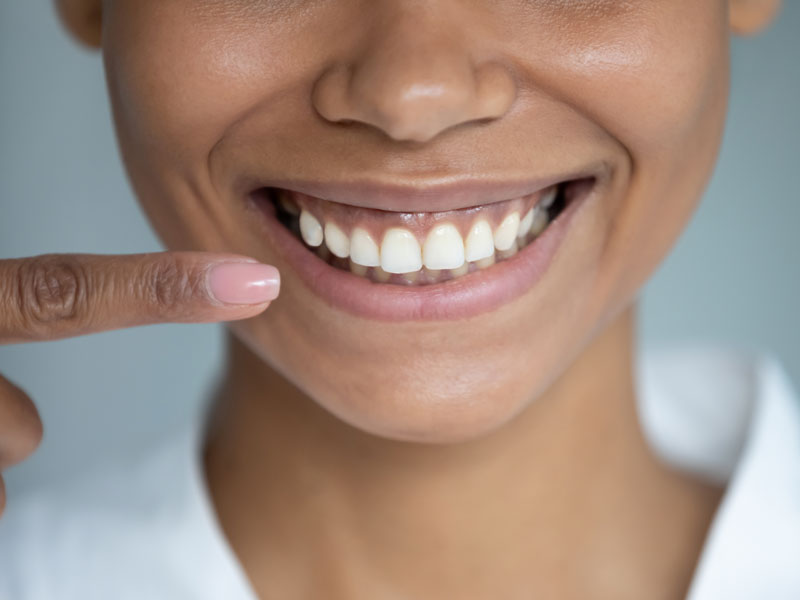 Gum Disease
